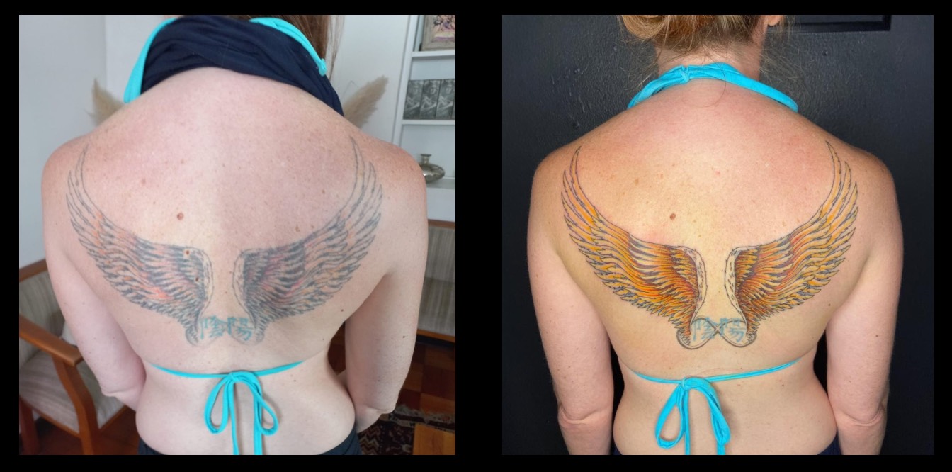 Restauración de tatuaje de mariposa en el cuello — antes y después — CAOS Art Tattoo Chile